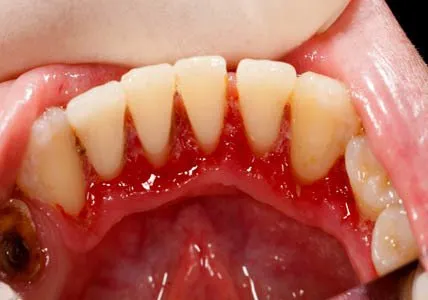 Periodontia
